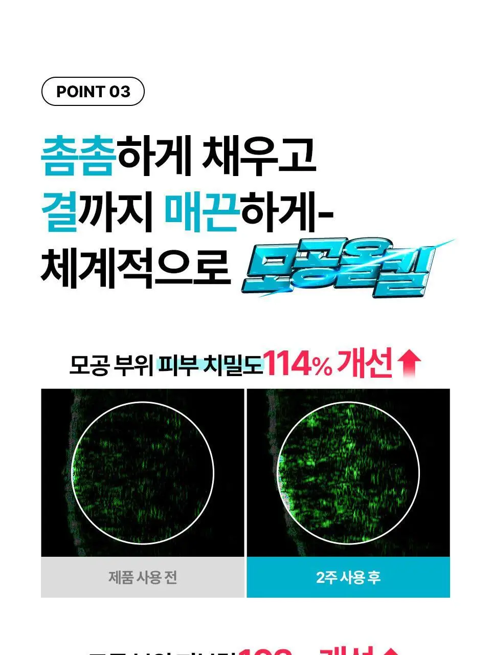 [모공탄력] 아이소이 포어 타이트닝 컨트롤 세럼 20ml 기획 (+3ml) 상세페이지 14